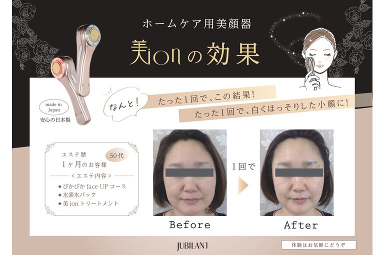 美ionビフォーアフター