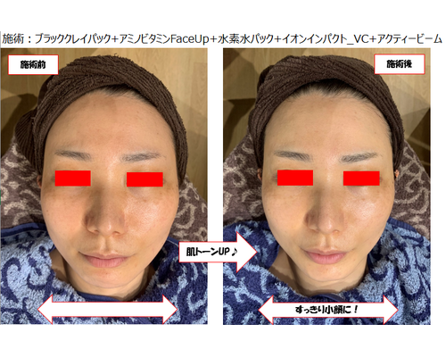 Y様ビフォーアフター