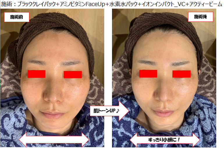 Y様ビフォーアフター